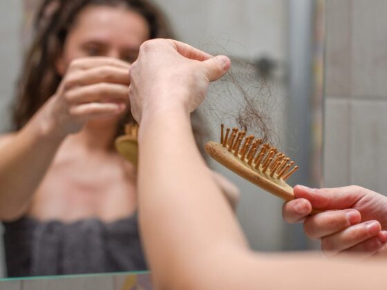 Managing Hair Loss with Trusted Treatments from Oxford Online Pharmacy
