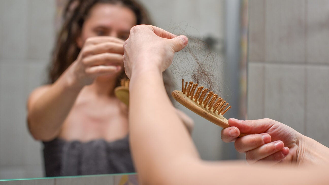 Managing Hair Loss with Trusted Treatments from Oxford Online Pharmacy